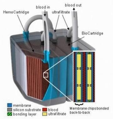 کلیه مصنوعی هم توسط دانشمندان ساخته شد