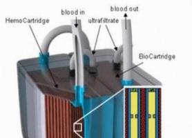 کلیه مصنوعی هم توسط دانشمندان ساخته شد