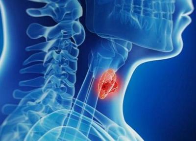 مواد خوراکی مفید برای افراد مبتلا به کم کاری تیروئید