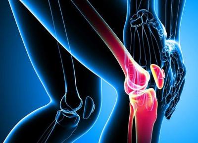 رژیمی مناسب برای افراد مبتلا به التهاب مفاصل