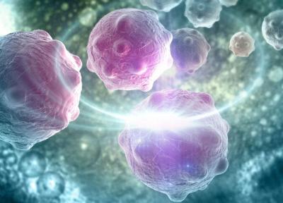 افزایش سرطان سینه در میان زنان جوان ایرانی ، ماموگرافی سبب ابتلا به سرطان نمی گردد