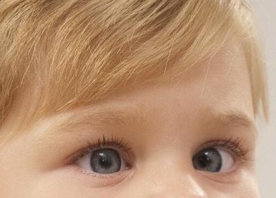 تنبلی چشم؛ رایج ترین دلیل نارسایی بینایی در بچه ها