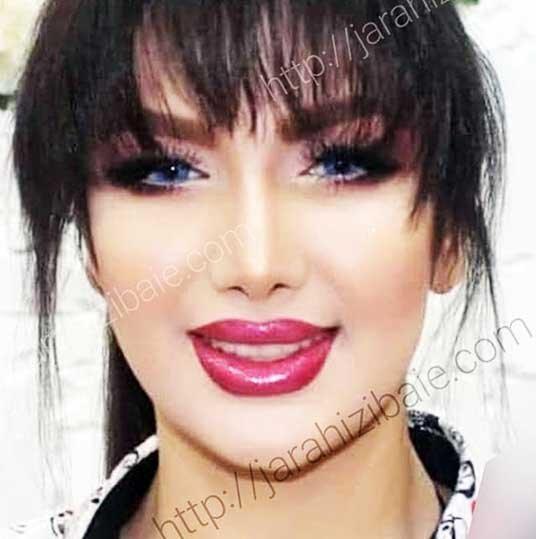 عمل بینی چگونه انجام می شود؟ عمل بینی چگونه انجام می گردد؟