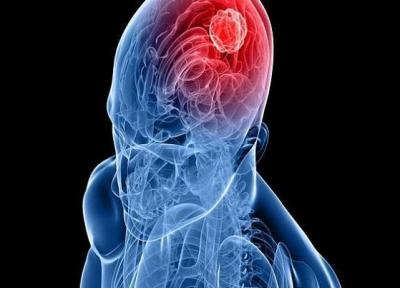 نابودی سرطان مغز با تلفیق چندین دارو