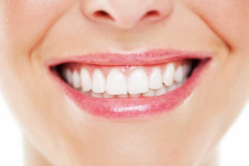 نقش سلول های ایمنی در ایجاد پوسیدگی دندان