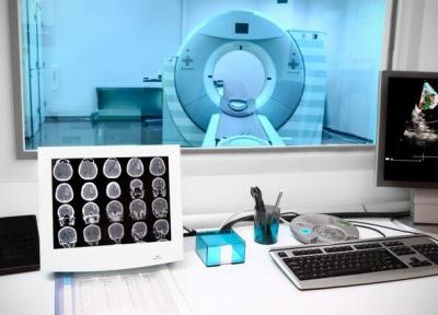بررسی بهتر مغز بیماران اسکیزوفرنیک با روش تصویربرداری جدید