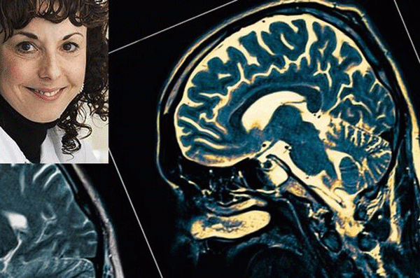 یافته جدید دانشمند ایرانی: تشخیص چند دهه زودتر بیماری آلزایمر