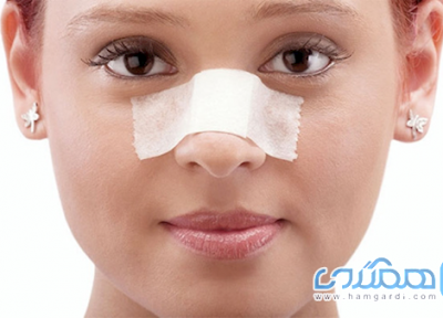 جراحی زیبایی برای این افراد اکیدا ممنوع