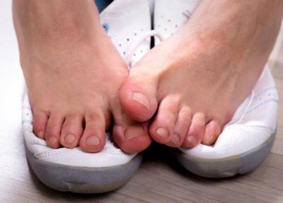 چطور از بوی بد پا جلوگیری کنیم؟