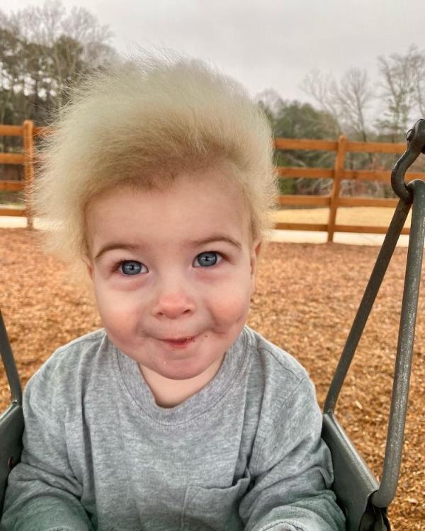 این کودک خردسال مبتلا به سندرم مو های غیر قابل شانه زدن مانند یک ستاره کوچک راک به نظر می رسد!