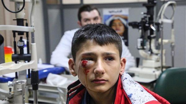 اقدامات لازم در مواجهه با مصدومان حوادث چهارشنبه سوری